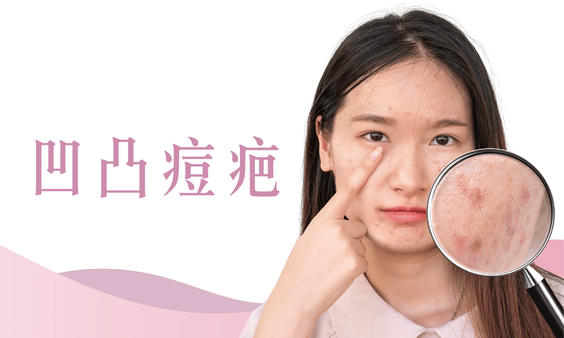 凹凸痘疤
