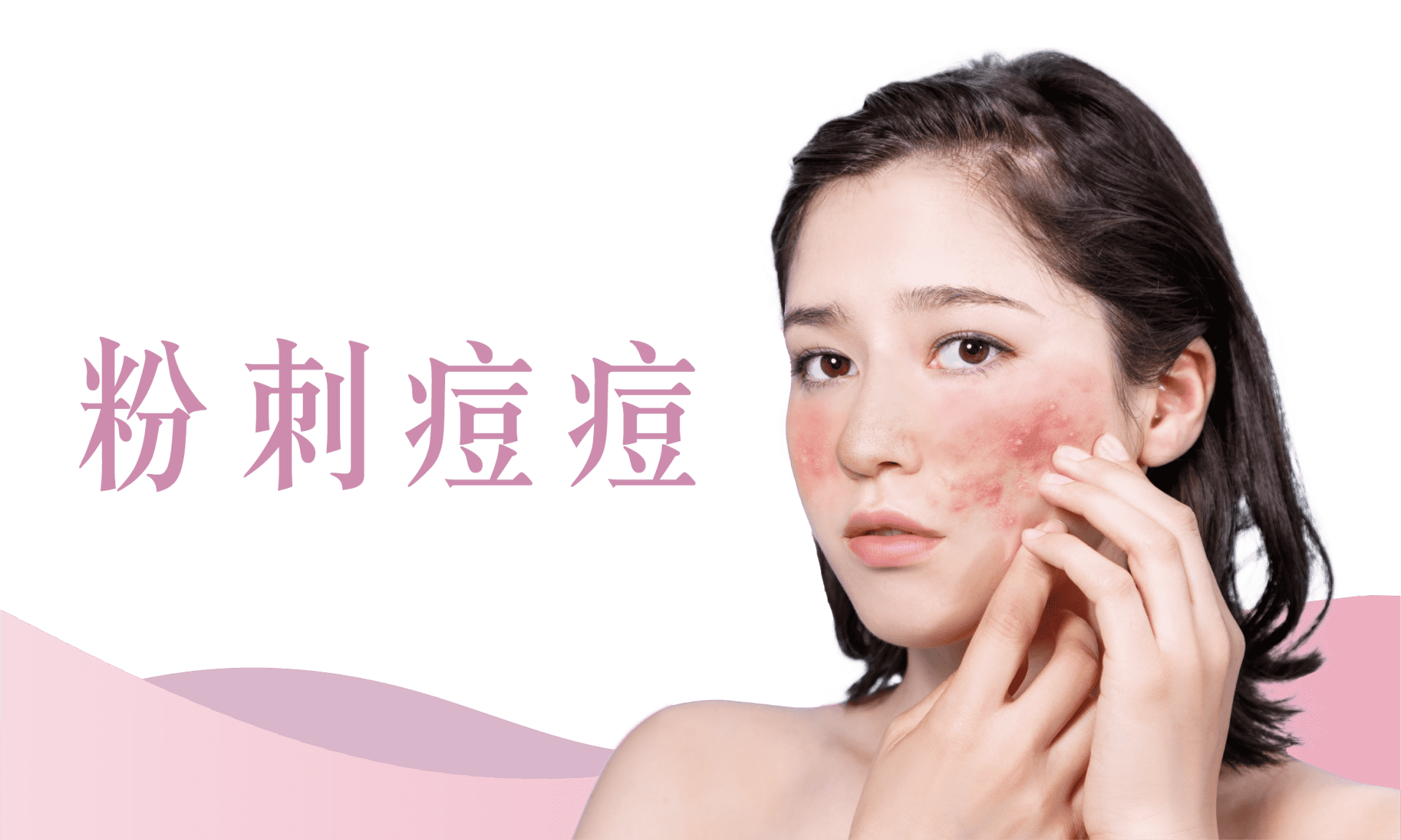 粉刺痘痘