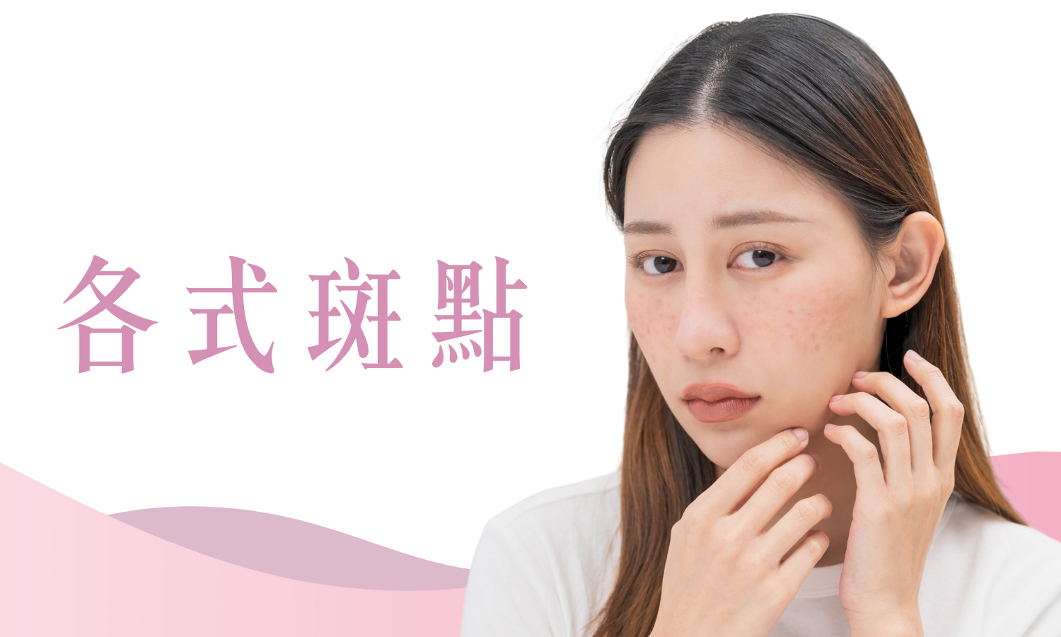 各式斑點