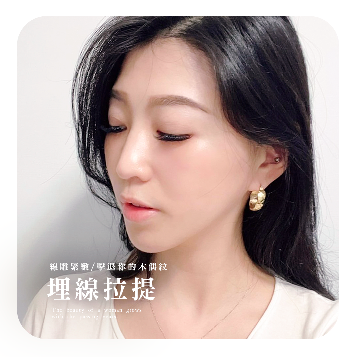 整形微整形